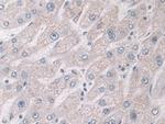 Glucocorticoid Receptor Antibody in Immunohistochemistry (Paraffin) (IHC (P))