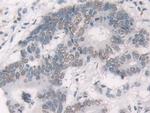 Glucocorticoid Receptor Antibody in Immunohistochemistry (Paraffin) (IHC (P))