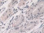 Glucocorticoid Receptor Antibody in Immunohistochemistry (Paraffin) (IHC (P))