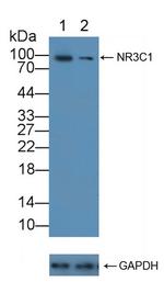 Glucocorticoid Receptor Antibody in Western Blot (WB)