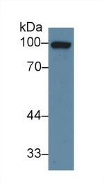 Glucocorticoid Receptor Antibody in Western Blot (WB)