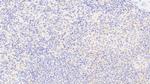 G6PD Antibody in Immunohistochemistry (Paraffin) (IHC (P))