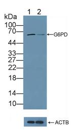 G6PD Antibody in Western Blot (WB)