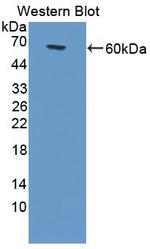 G6PD Antibody in Western Blot (WB)