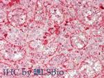 GUSB Antibody in Immunohistochemistry (Paraffin) (IHC (P))