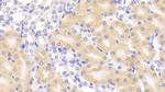 Glutaminase Antibody in Immunohistochemistry (Paraffin) (IHC (P))