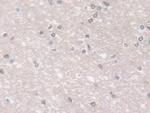 GPX3 Antibody in Immunohistochemistry (Paraffin) (IHC (P))