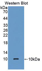 GPX3 Antibody in Western Blot (WB)