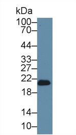 GPX4 Antibody in Western Blot (WB)