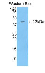 GPX4 Antibody in Western Blot (WB)