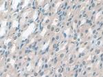 GSTM4 Antibody in Immunohistochemistry (Paraffin) (IHC (P))