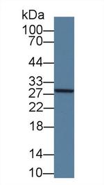 GSTM4 Antibody in Western Blot (WB)