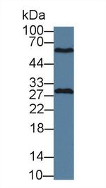 GSTM4 Antibody in Western Blot (WB)