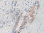 PYGB Antibody in Immunohistochemistry (Paraffin) (IHC (P))