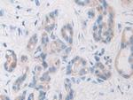 PYGB Antibody in Immunohistochemistry (Paraffin) (IHC (P))