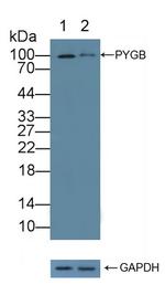 PYGB Antibody in Western Blot (WB)