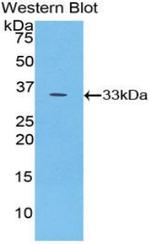 PYGB Antibody in Western Blot (WB)