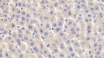 PYGL Antibody in Immunohistochemistry (Paraffin) (IHC (P))