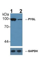 PYGL Antibody in Western Blot (WB)