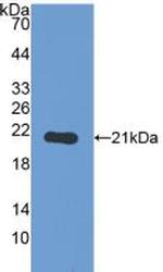 PYGL Antibody in Western Blot (WB)