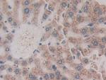 CD42a Antibody in Immunohistochemistry (Paraffin) (IHC (P))