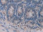 CD42a Antibody in Immunohistochemistry (Paraffin) (IHC (P))