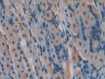 GREM1 Antibody in Immunohistochemistry (Paraffin) (IHC (P))