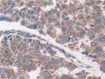 GRB10 Antibody in Immunohistochemistry (Paraffin) (IHC (P))