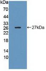 GRB10 Antibody in Western Blot (WB)