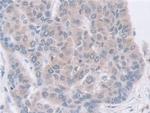 GDA Antibody in Immunohistochemistry (Paraffin) (IHC (P))