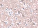 GDA Antibody in Immunohistochemistry (Paraffin) (IHC (P))