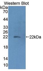 Haptoglobin Antibody in Western Blot (WB)