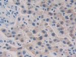 HAUS7 Antibody in Immunohistochemistry (Paraffin) (IHC (P))