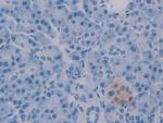 HAUS7 Antibody in Immunohistochemistry (Paraffin) (IHC (P))