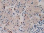 HAUS7 Antibody in Immunohistochemistry (Paraffin) (IHC (P))