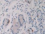 HAUS7 Antibody in Immunohistochemistry (Paraffin) (IHC (P))