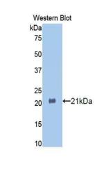 HSPBP1 Antibody in Western Blot (WB)