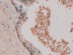 HSPA1A Antibody in Immunohistochemistry (Paraffin) (IHC (P))