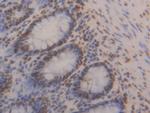 hnRNP A2B1 Antibody in Immunohistochemistry (Paraffin) (IHC (P))