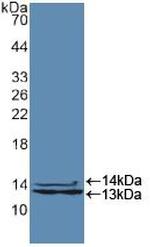 hnRNP A2B1 Antibody in Western Blot (WB)