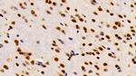 HMGB1 Antibody in Immunohistochemistry (Paraffin) (IHC (P))