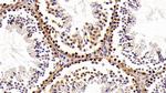 HMGB1 Antibody in Immunohistochemistry (Paraffin) (IHC (P))