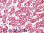 HAO1 Antibody in Immunohistochemistry (Paraffin) (IHC (P))