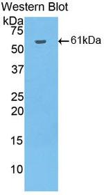 HAO1 Antibody in Western Blot (WB)