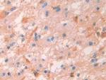 Human IgG4 Antibody in Immunohistochemistry (Paraffin) (IHC (P))