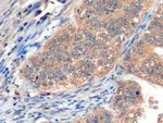 CD275 (B7-H2) Antibody in Immunohistochemistry (Paraffin) (IHC (P))