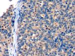 CD275 (B7-H2) Antibody in Immunohistochemistry (Paraffin) (IHC (P))