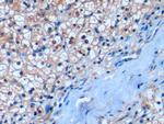 CD275 (B7-H2) Antibody in Immunohistochemistry (Paraffin) (IHC (P))