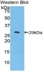 CD275 (B7-H2) Antibody in Western Blot (WB)