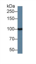 INPP4A Antibody in Western Blot (WB)